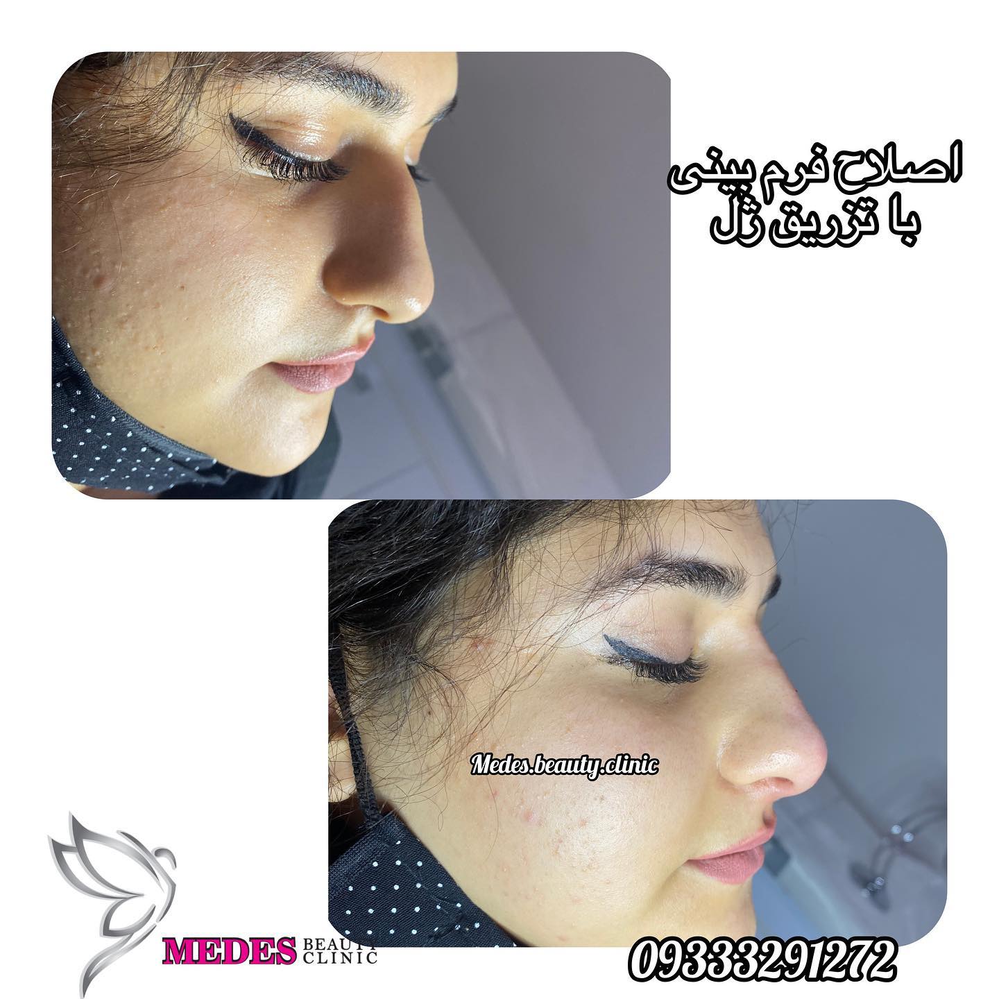 گالری اصلاح فرم بینی